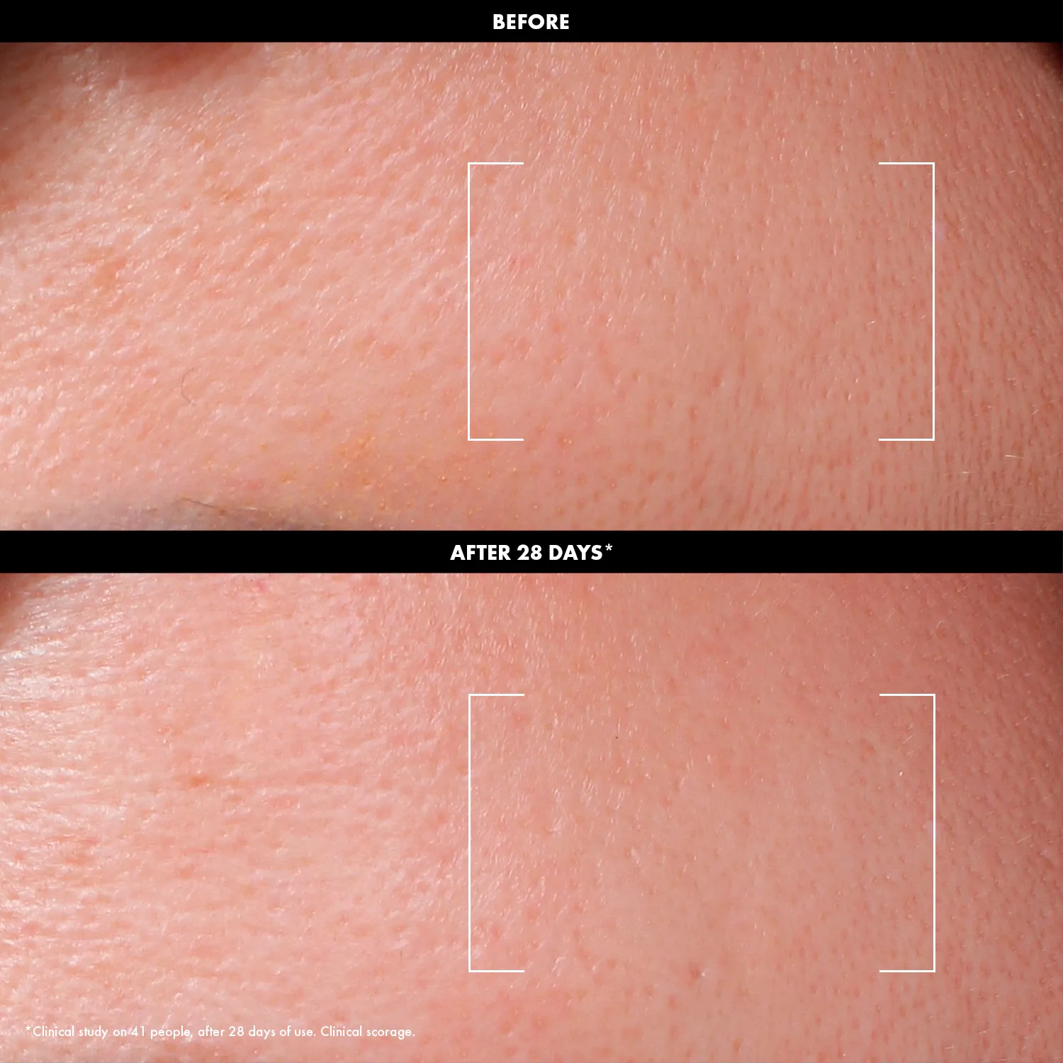 exfoliate - %3 aha + %2 c vitamini içeren günlük peeling losyonu