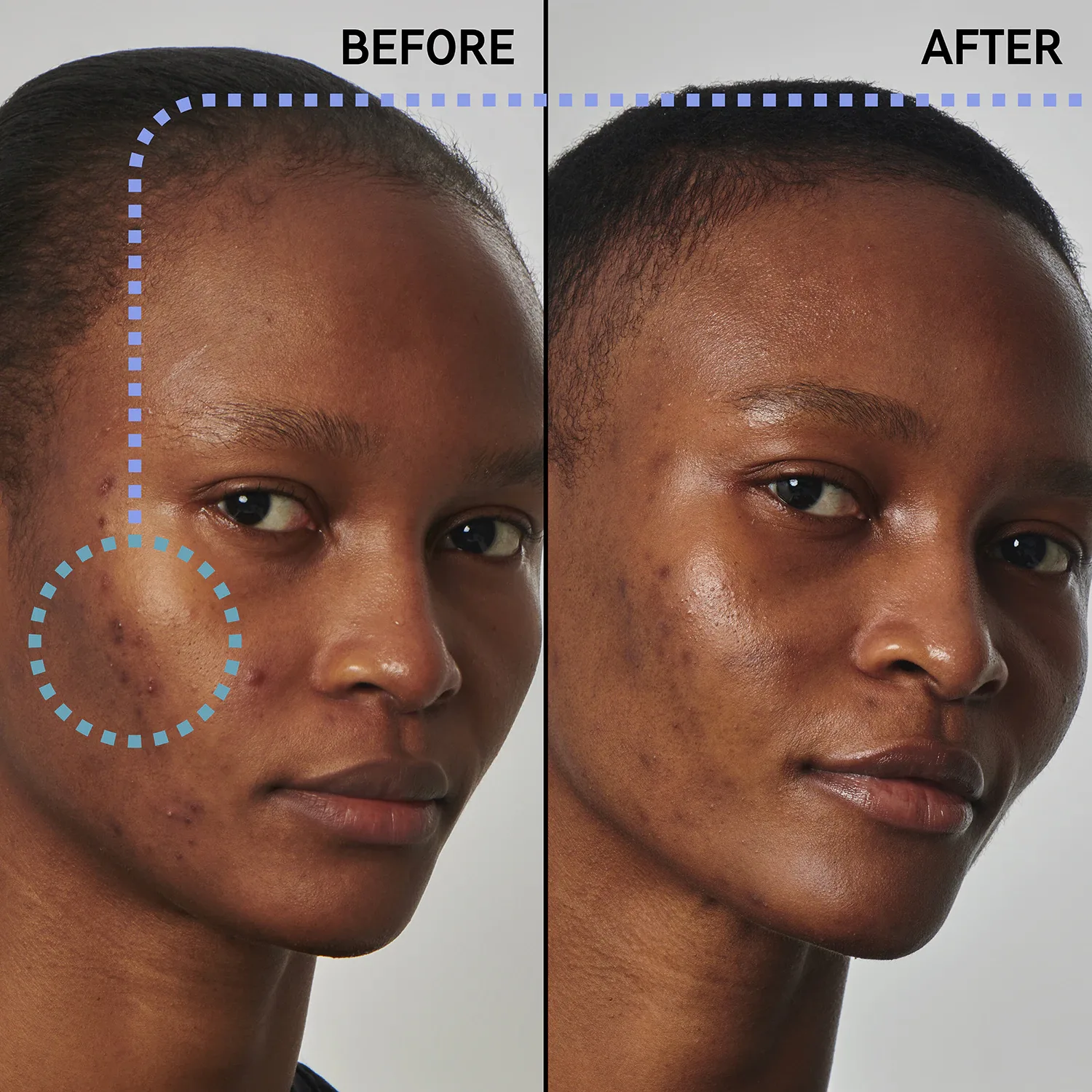 excess oil solution with 20% niacinamide - yüz serumu