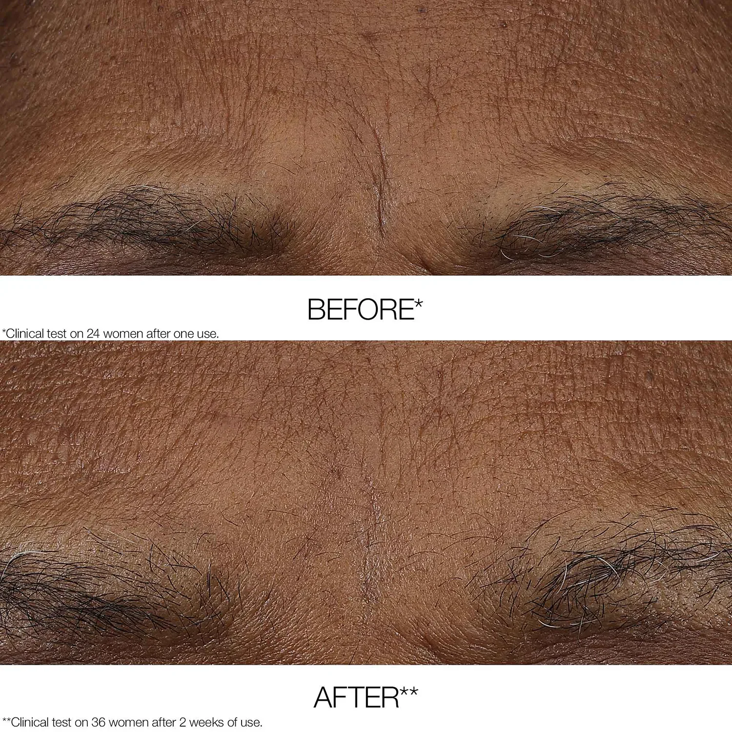 clinique smart clinical repair™ - am/pm retinoid balm