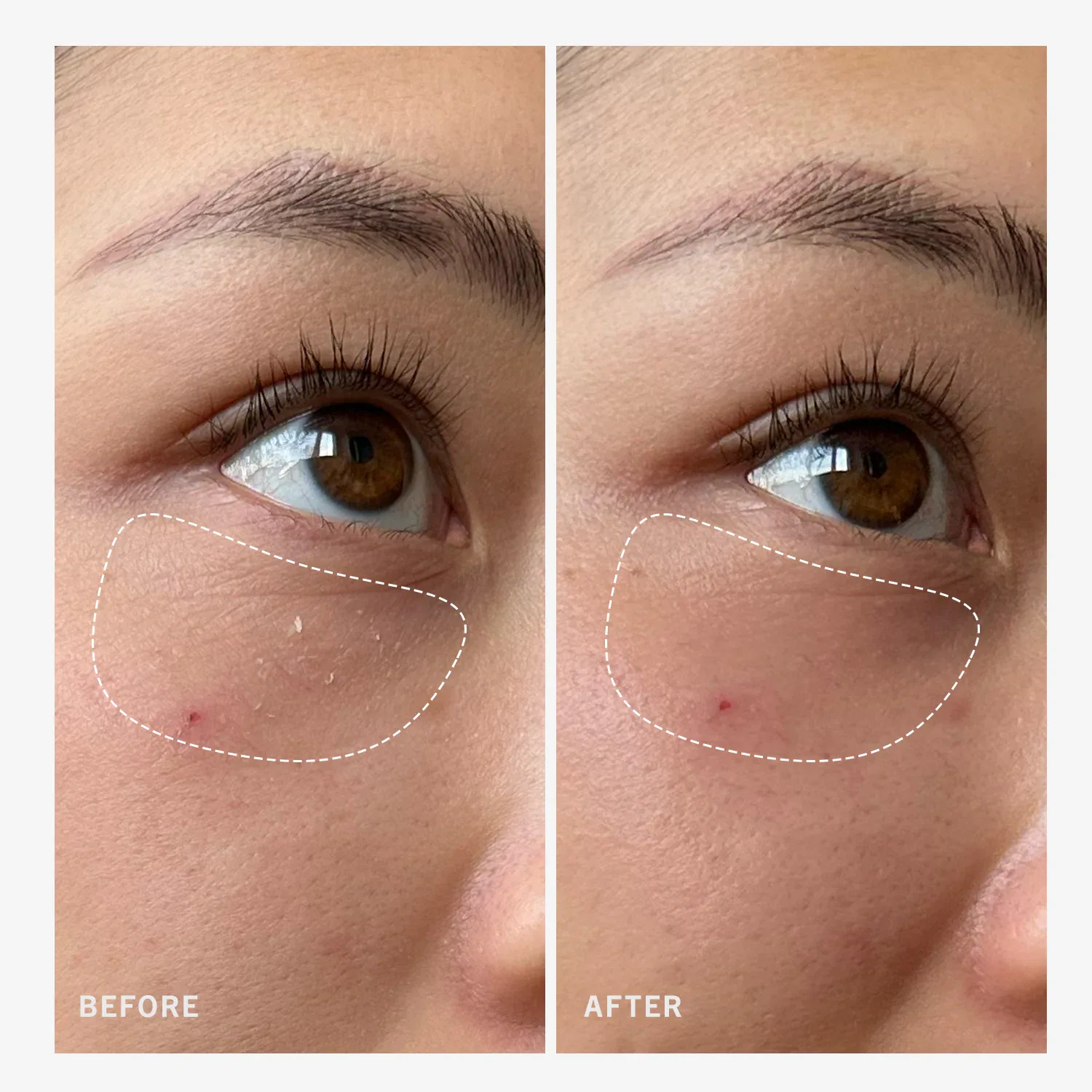 ultra repair rescue balm - dimetikonlu ultra onarıcı rahatlatıcı balsam