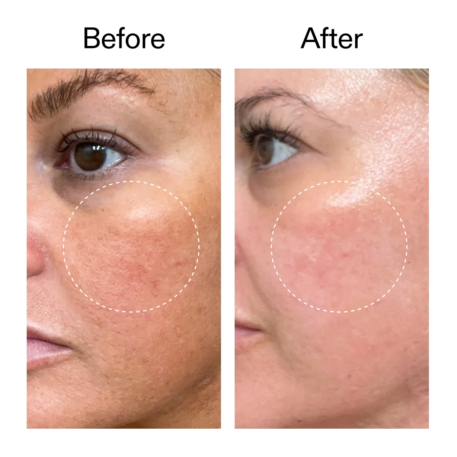 starter retinol serum - retinol başlangıç serumu