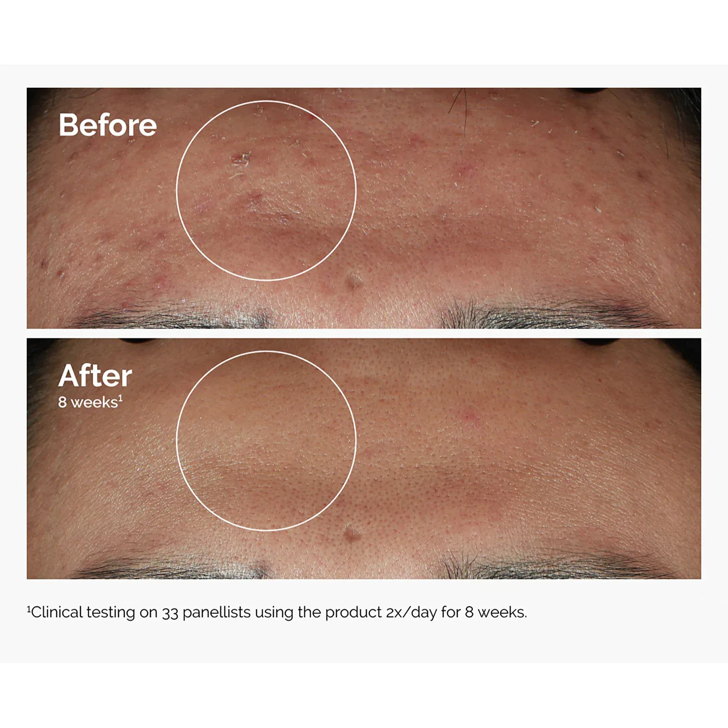 niacinamide 10% + zinc 1% - leke ve gözenek görünümü karşıtı serum