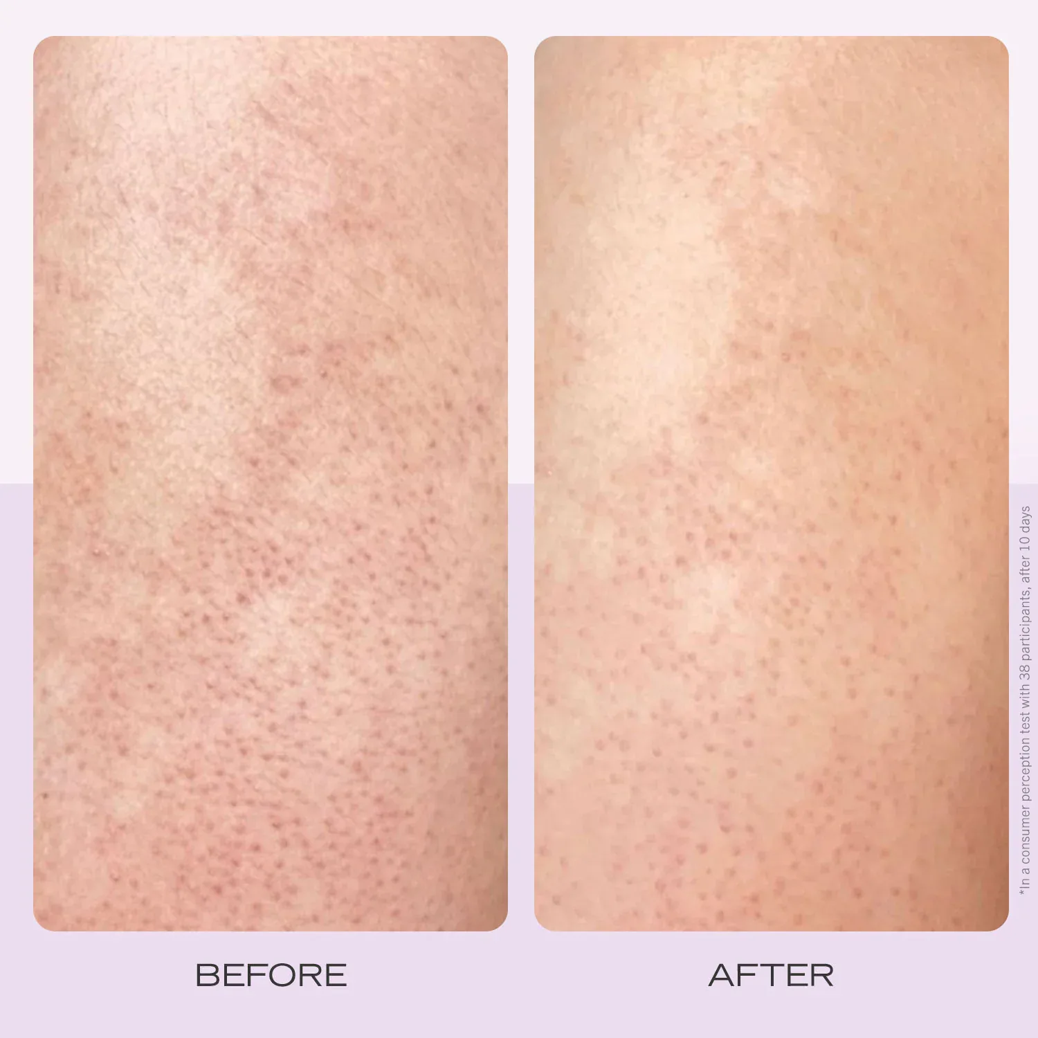 soft + smooth starter kit - yumuşaklık + pürüzsüzlük verici başlangıç seti