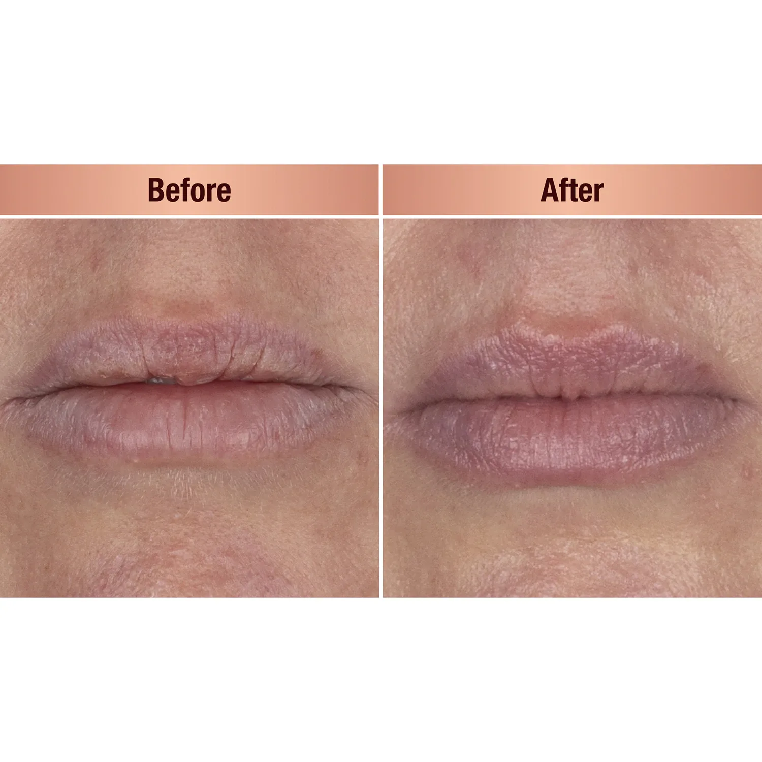 life changing lip mask - dudaklar için gece bakım maskesi