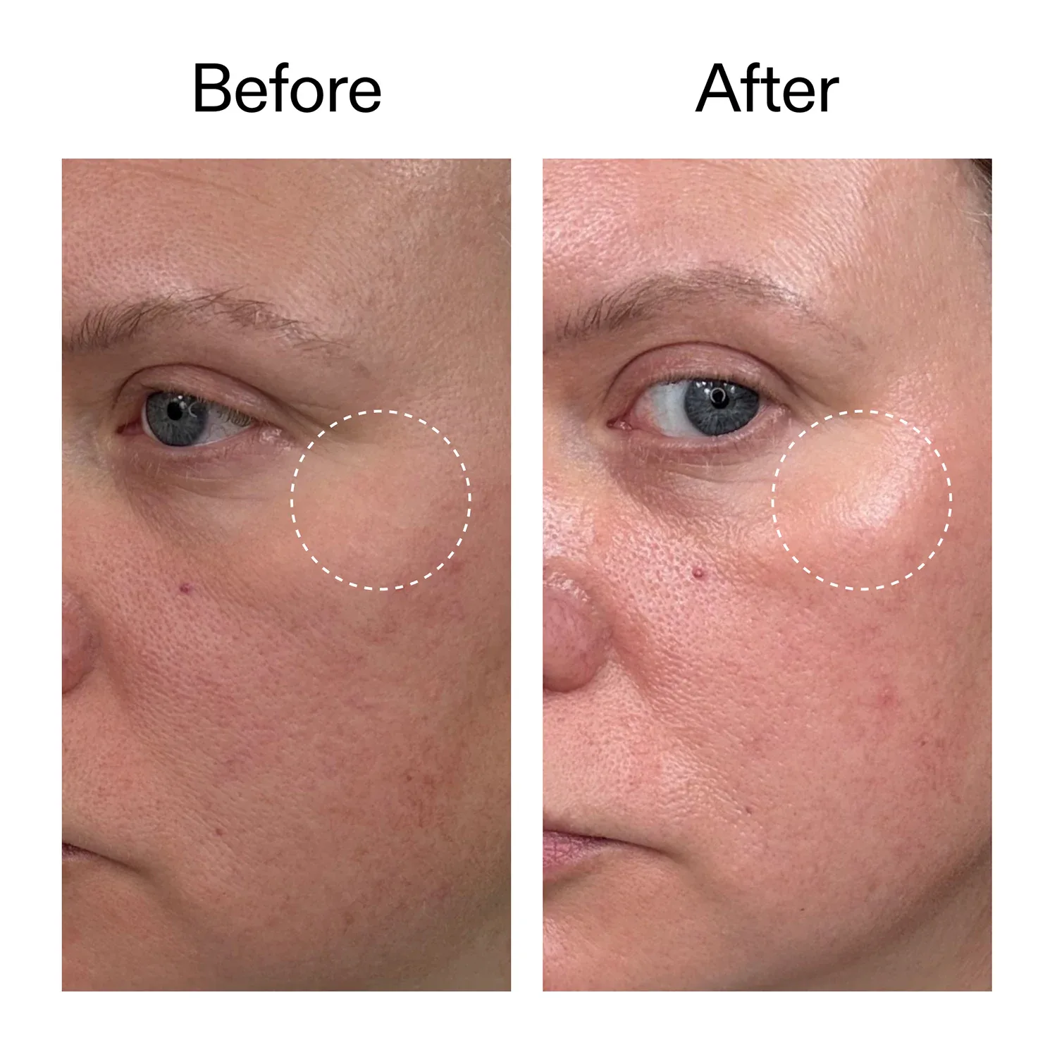 advanced retinal serum - gelişmiş retinal serum