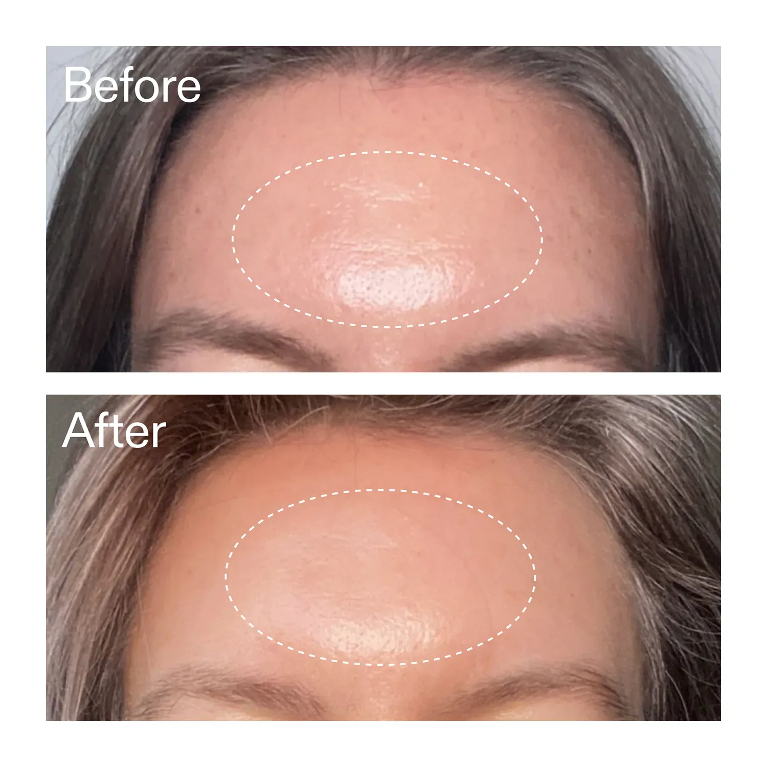 advanced retinal serum - gelişmiş retinal serum