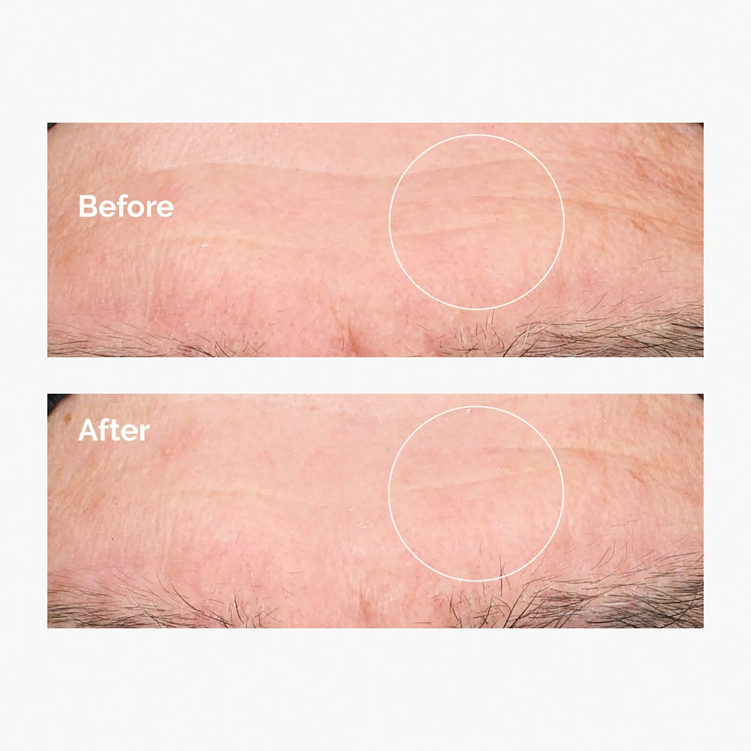 hyaluronic acid 2% + b5 - derinlemesine nemlendirici serum