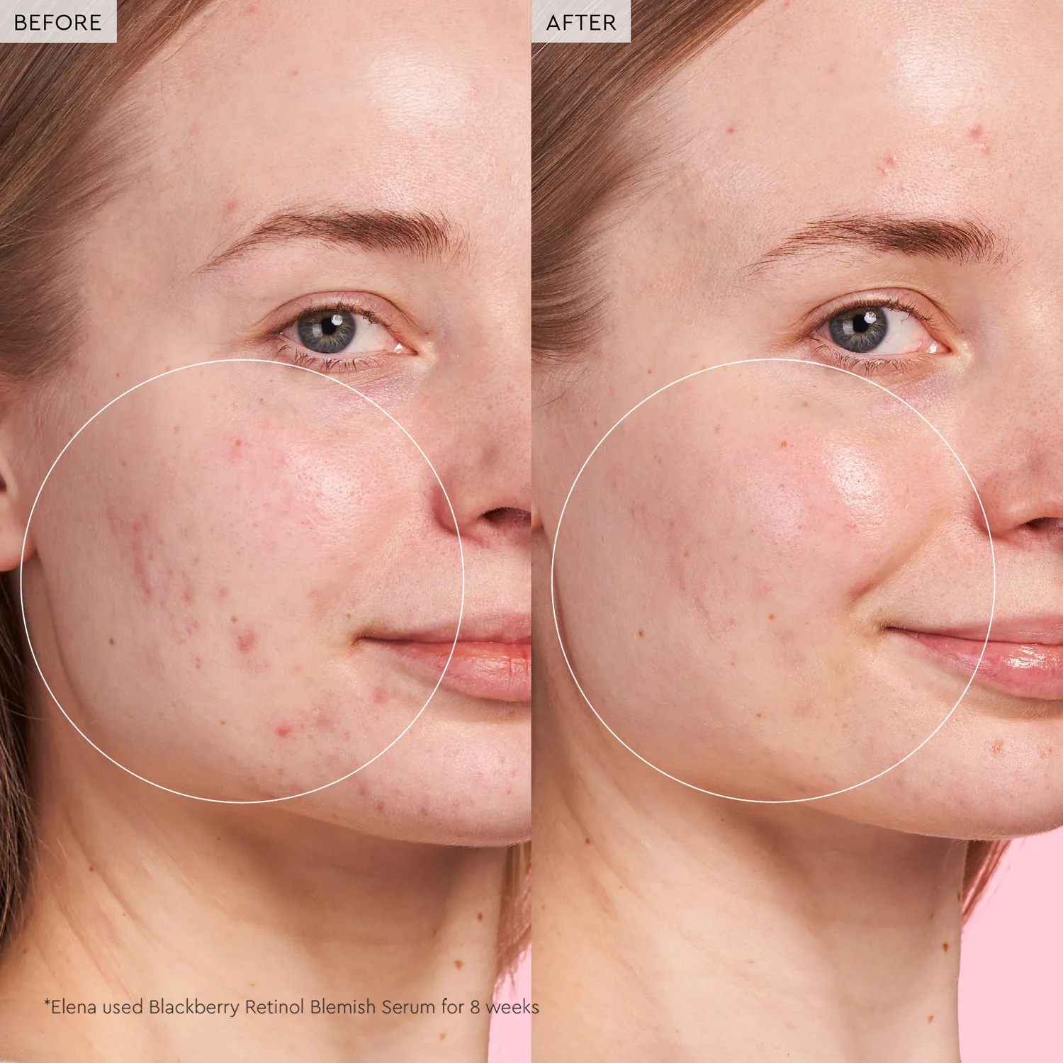 blackberry retinol – yenileyici serum