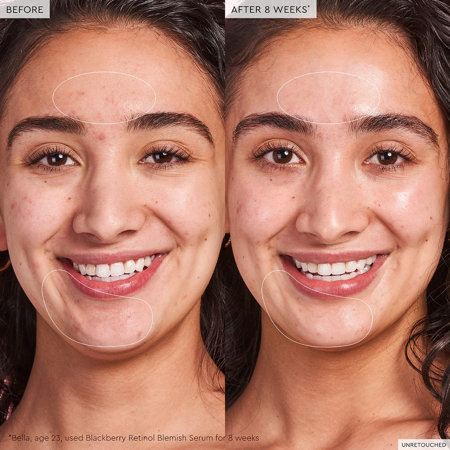 blackberry retinol – yenileyici serum