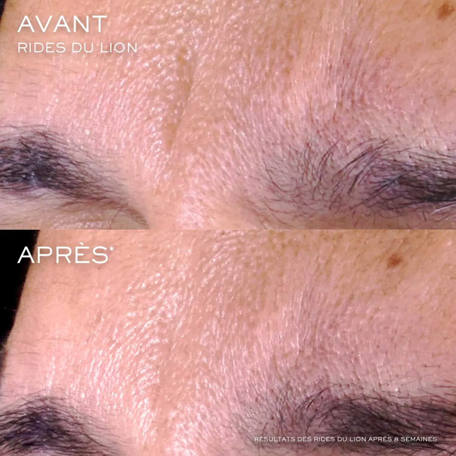 rénergie triple serum retinol - yaşlanma karşıtı serum