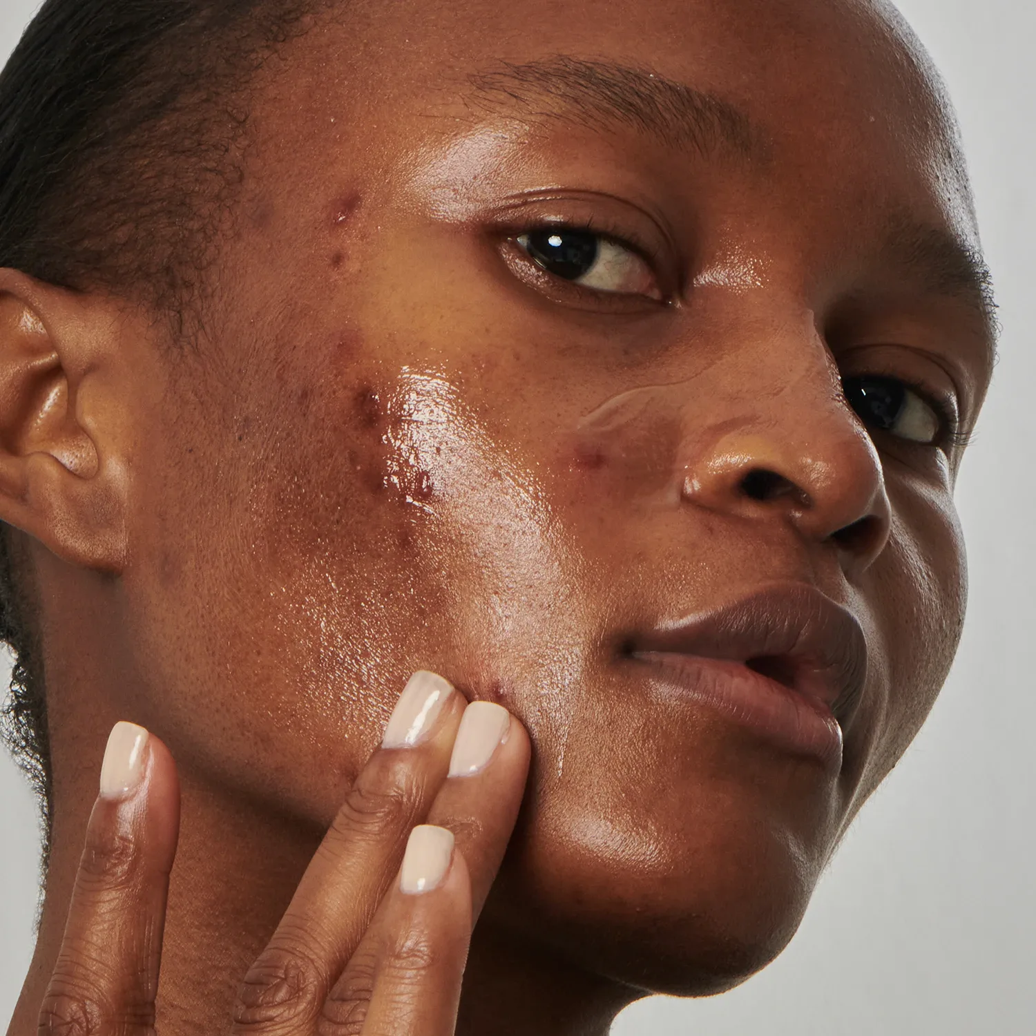 excess oil solution with 20% niacinamide - yüz serumu