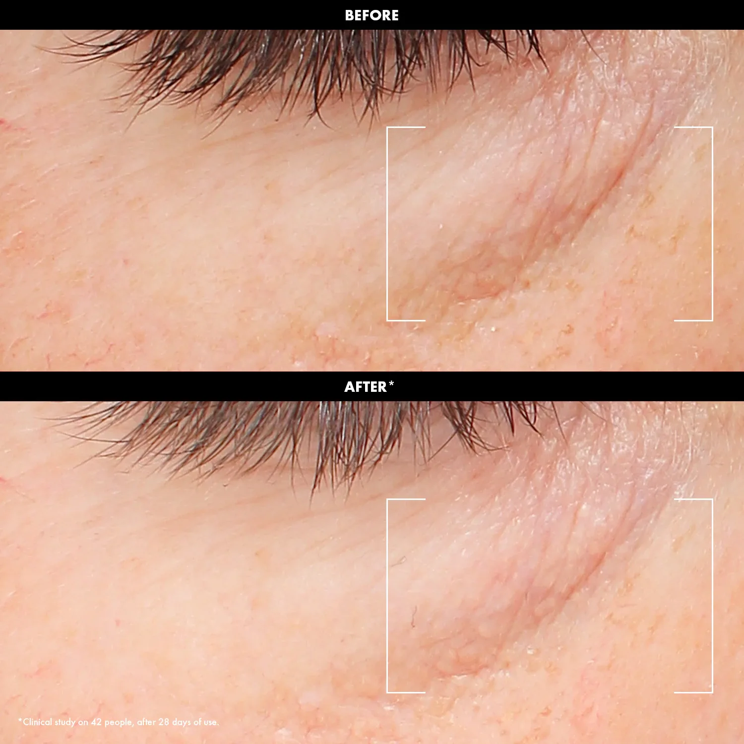 glow - c vitamini ve hyaluronik asit içeren ışıltı verici göz kremi