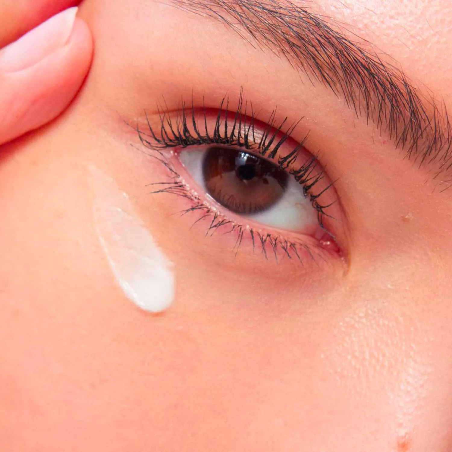 total eye lift - yaşlanma karşıtı göz çevresi bakımı