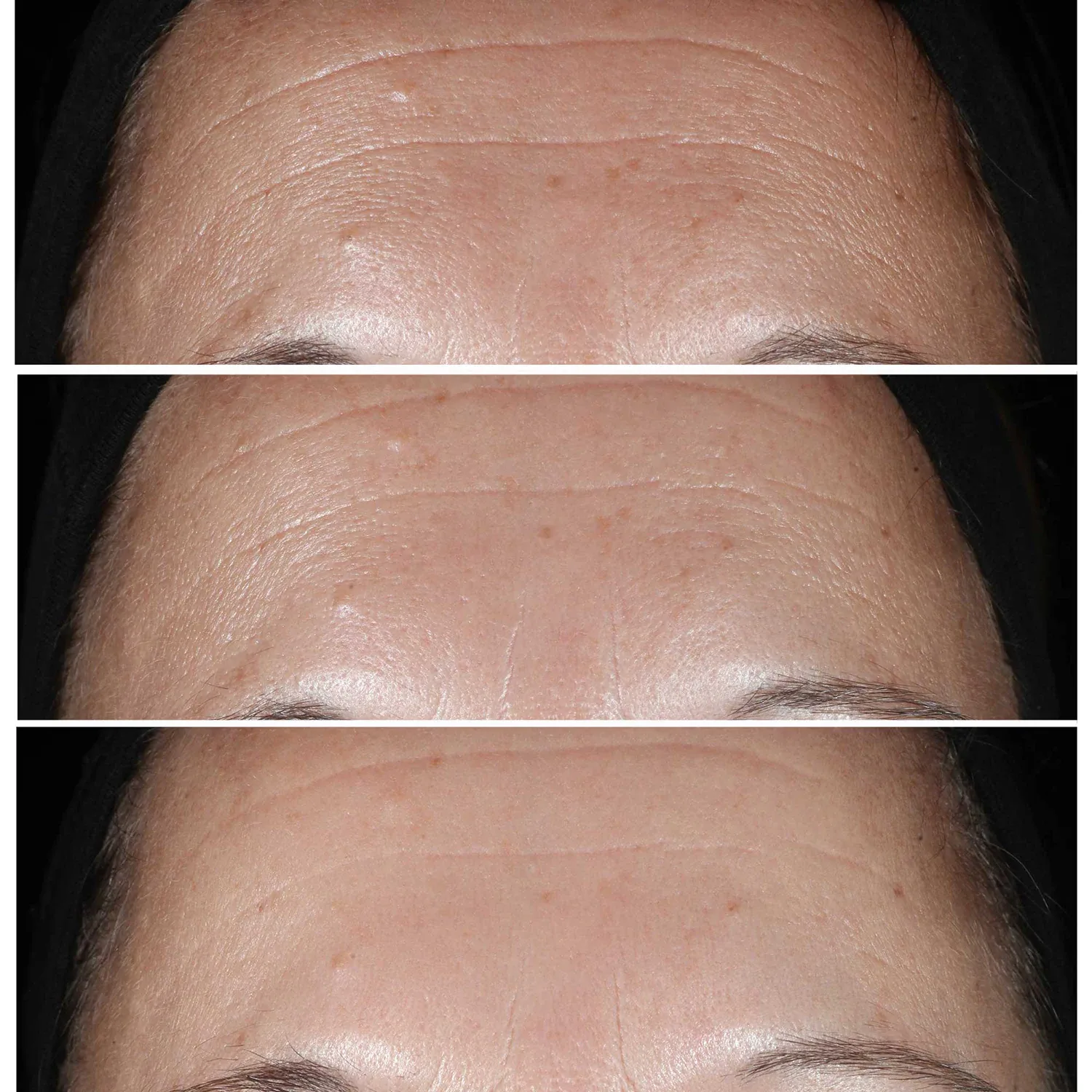 smart clinical repair™ - kırışıklık karşıtı düzeltici serum