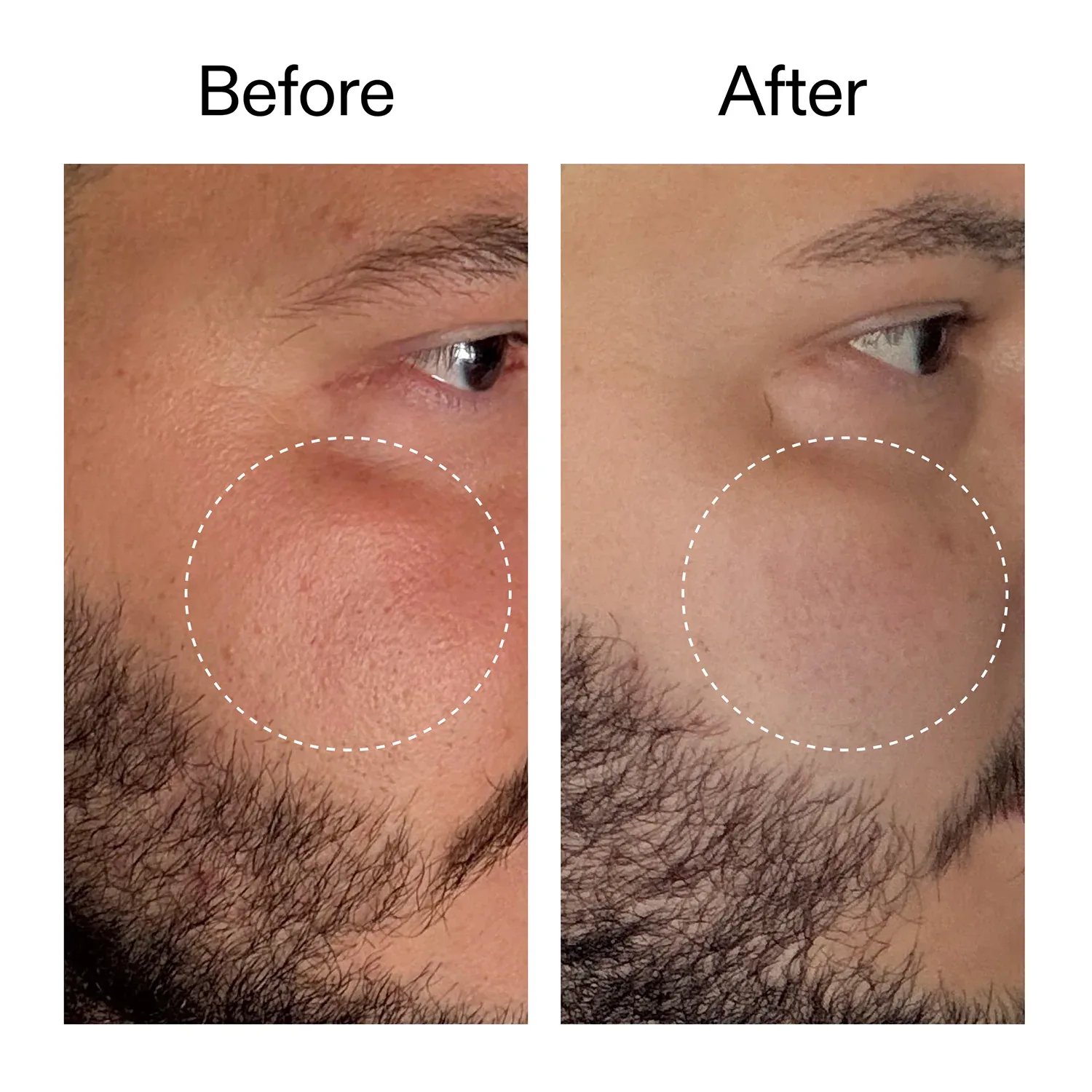 starter retinol serum - retinol başlangıç serumu
