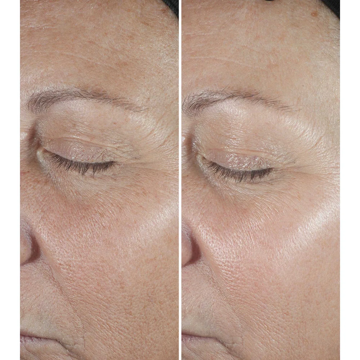 smart clinical repair™ - kırışıklık karşıtı düzeltici serum